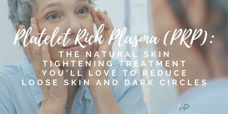 Platelet Rich Plasma (PRP): The Natural Skin Tightening Treatment You'll Love To Reduce Loose Skin And Dark Circles Platelet Rich Plasma (PRP): The Natural Skin Tightening Treatment You'll Love To Reduce Loose Skin And Dark Circles